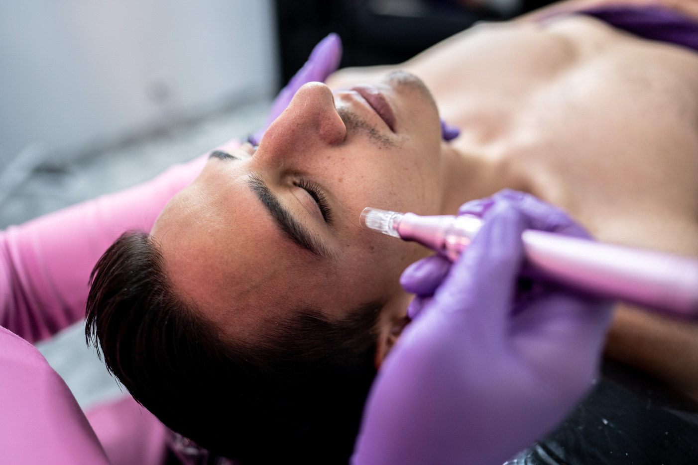Dermatologist/aesthetician using a microneedling equipment on a patient at clinic